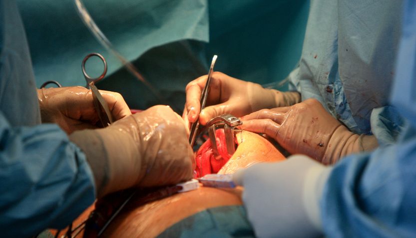 Complex Biliary Stricture