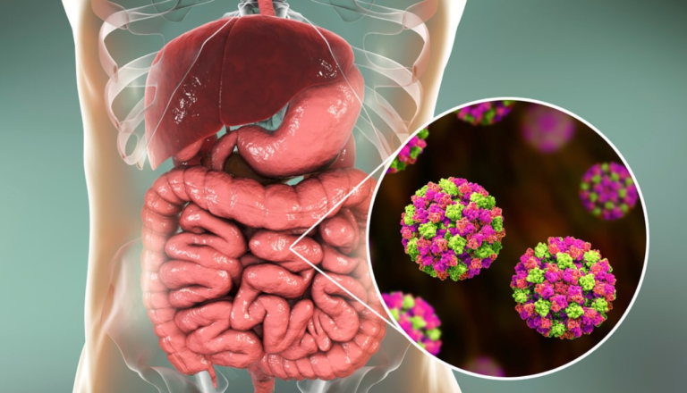 Gastrointestinal concerns and expert care tips