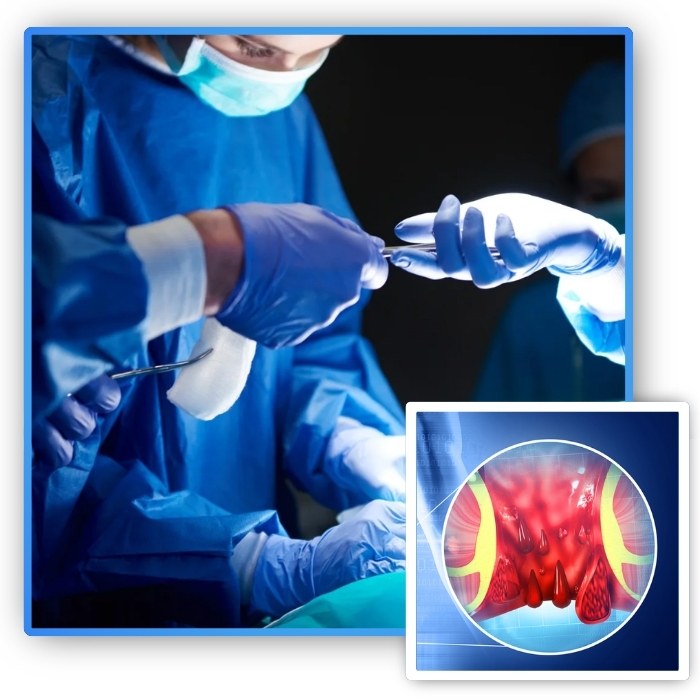 best doctor for piles surgery in bhubaneswar