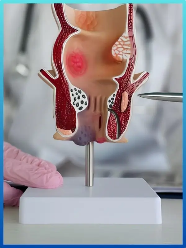 Hernia Understanding by Doctor Mahapatra