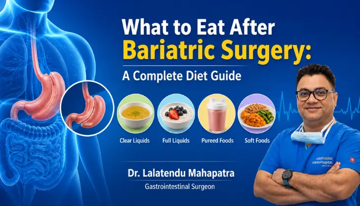 Bariatric Surgery Diet Plan for Fast Recovery