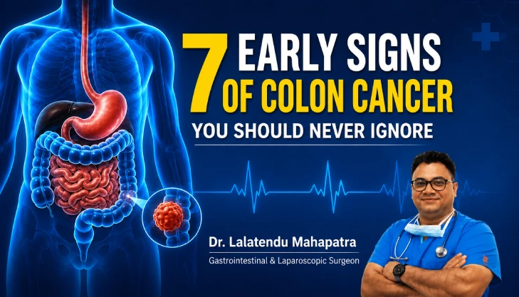 Colon cancer symptoms and early warning signs