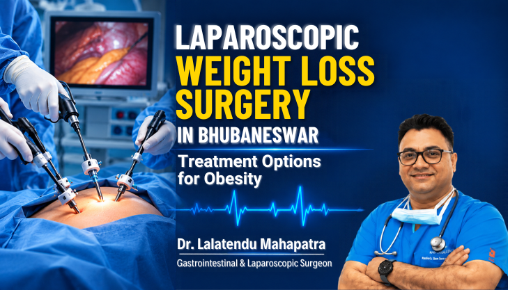Laparoscopic weight loss surgery options for obesity treatment, including sleeve gastrectomy and gastric bypass