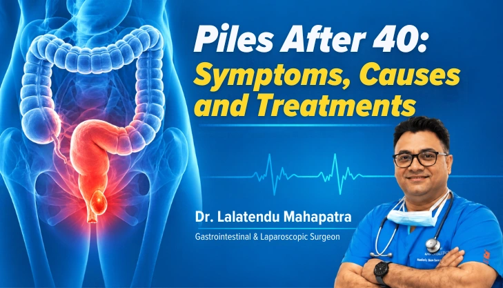 Piles After 40: Symptoms, Causes and Treatment Options